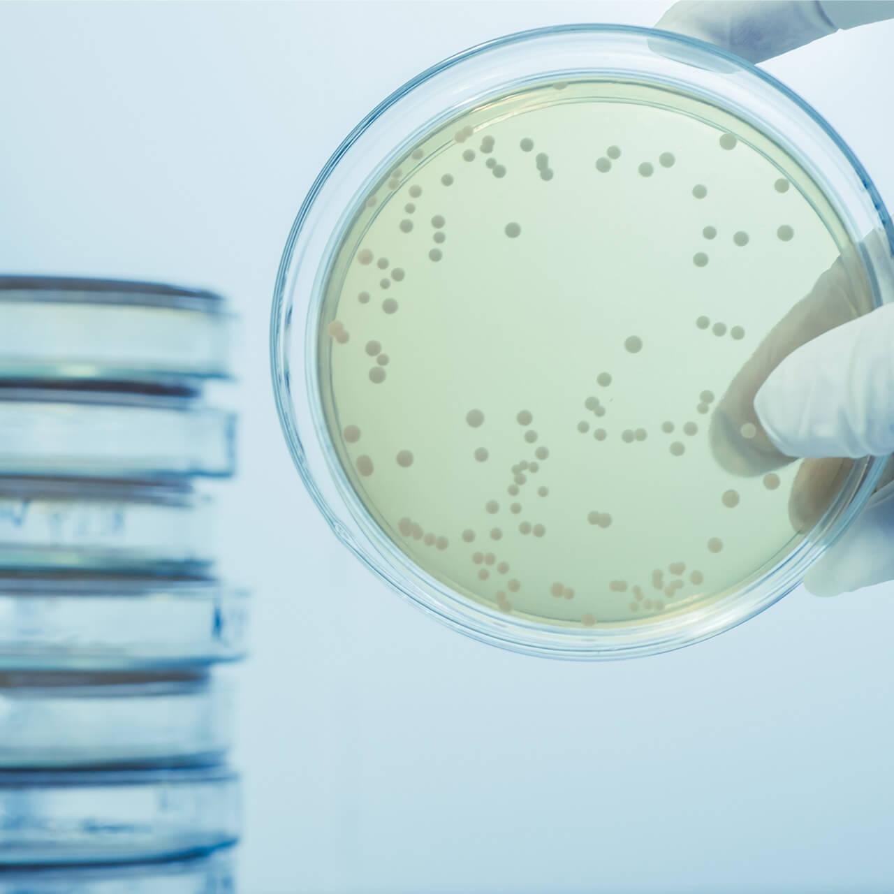 microbiological monitoring